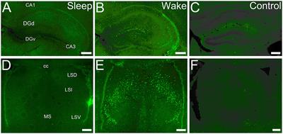 cFOS as a biomarker of activity maturation in the hippocampal formation